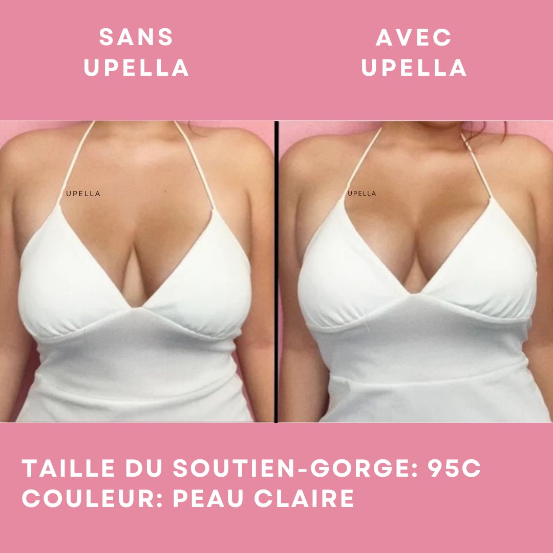 UPELLA - Coussinets Collants