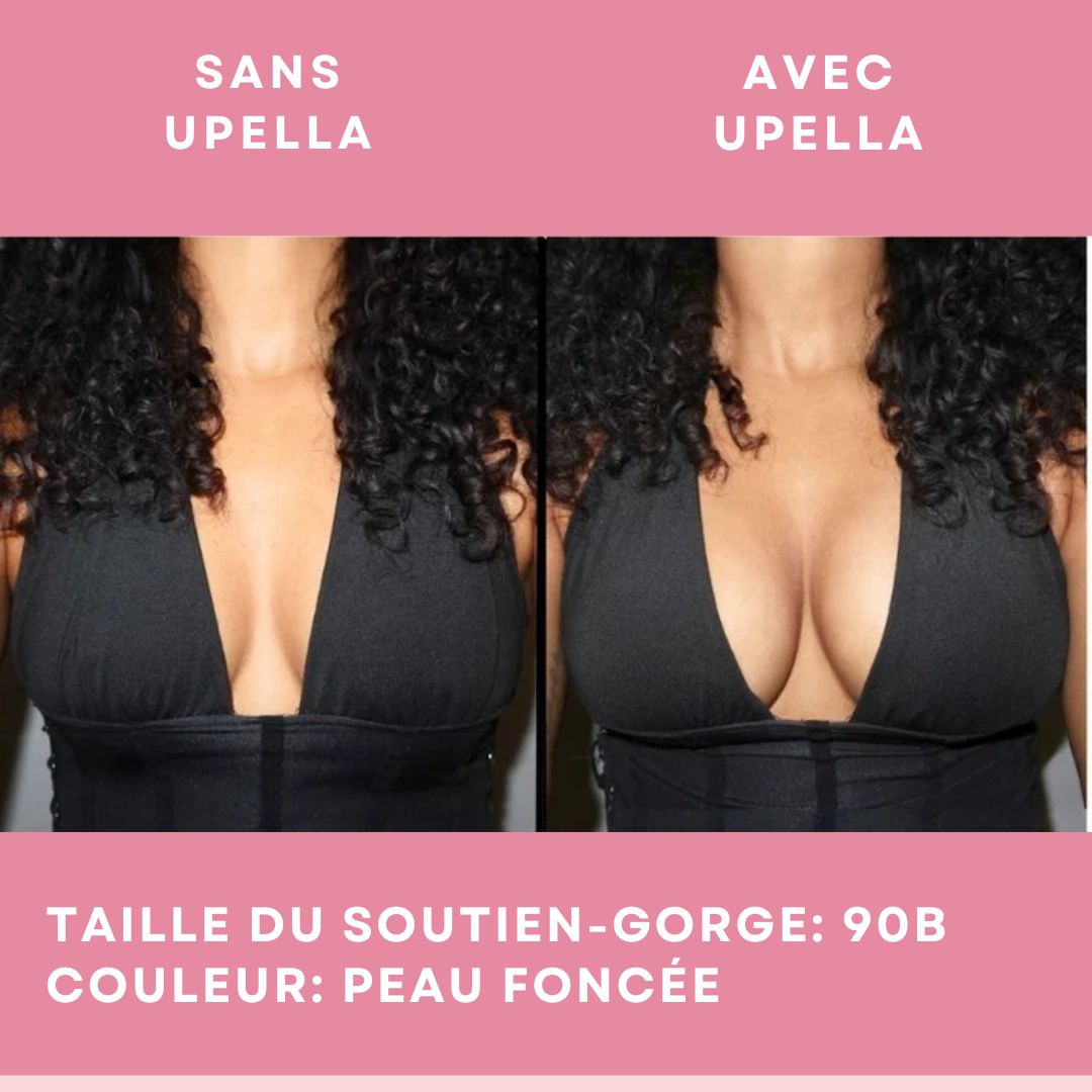 UPELLA - Coussinets Collants