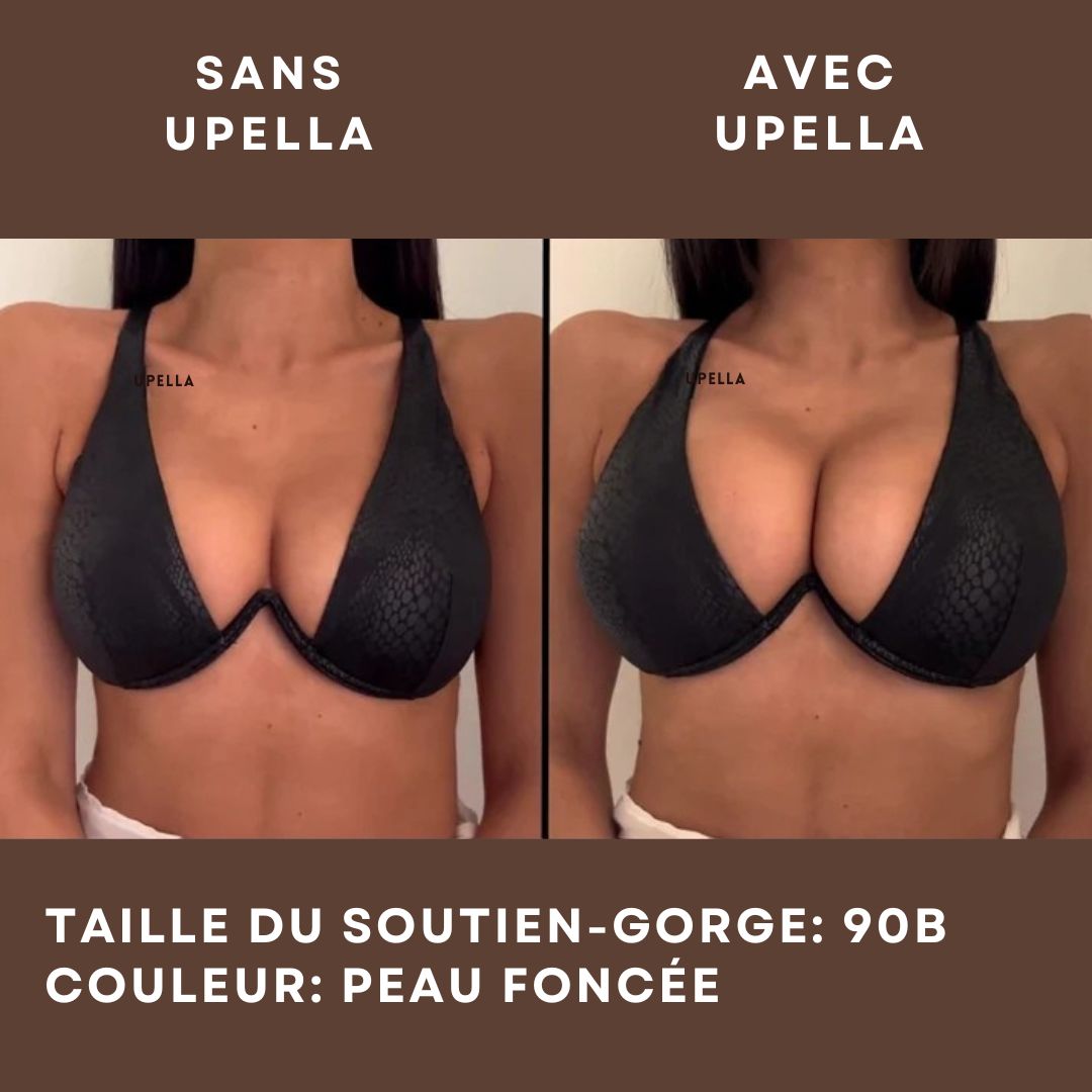 UPELLA - Coussinets Collants